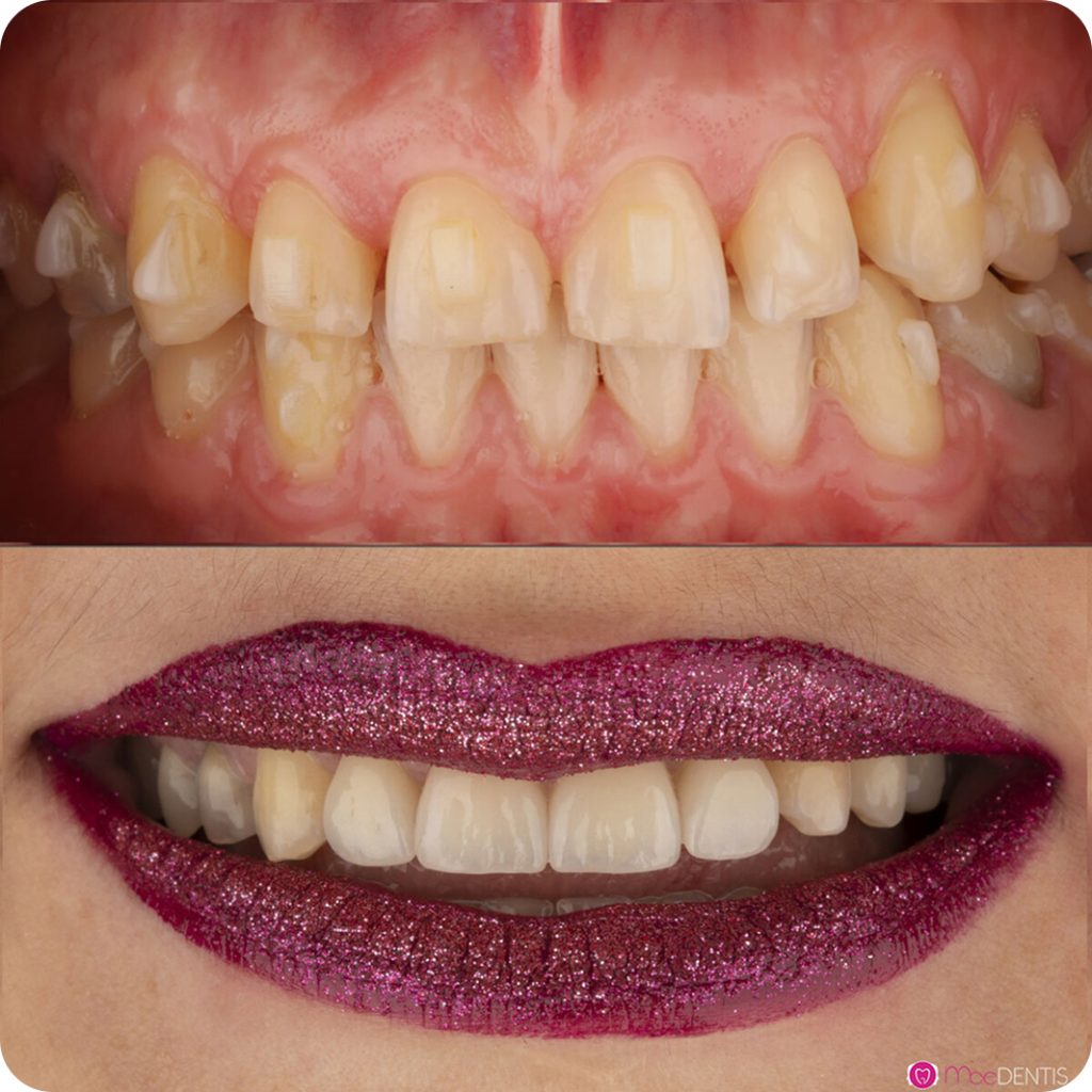 smile1